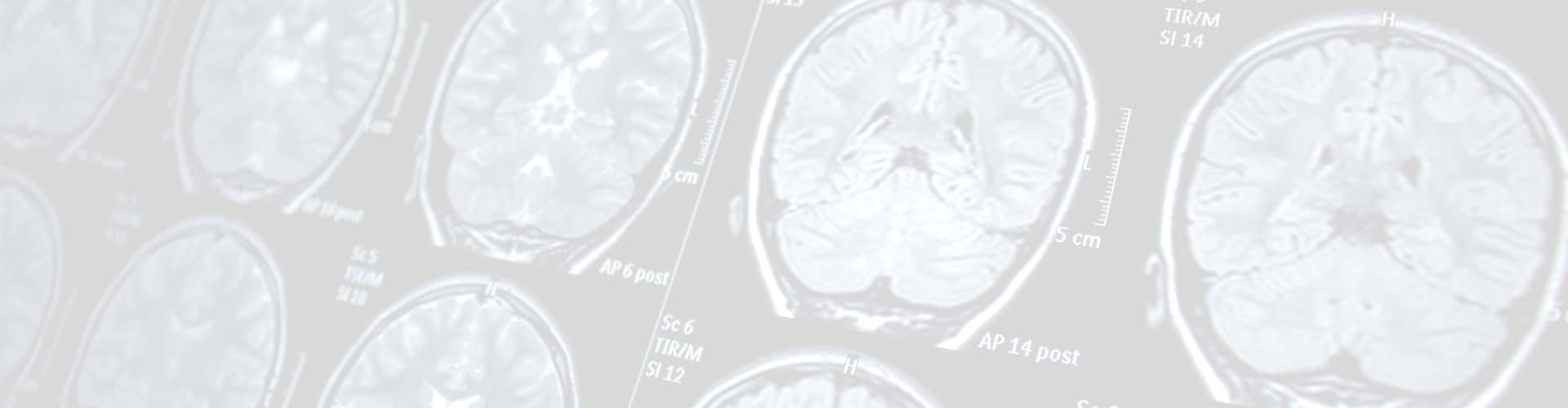 brain mri results