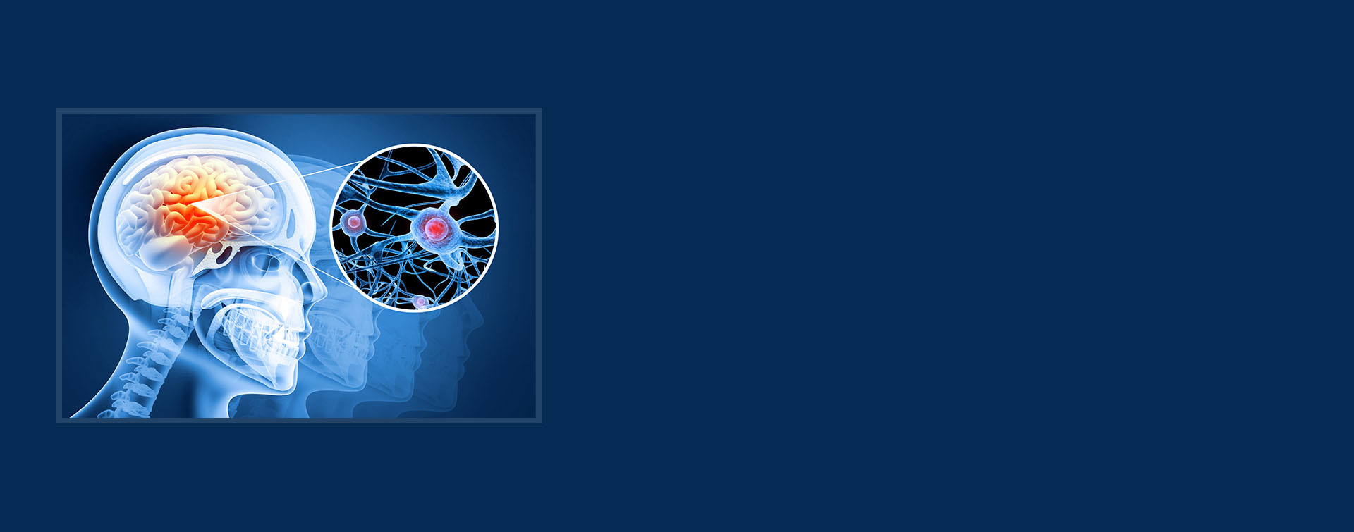 brain injury header