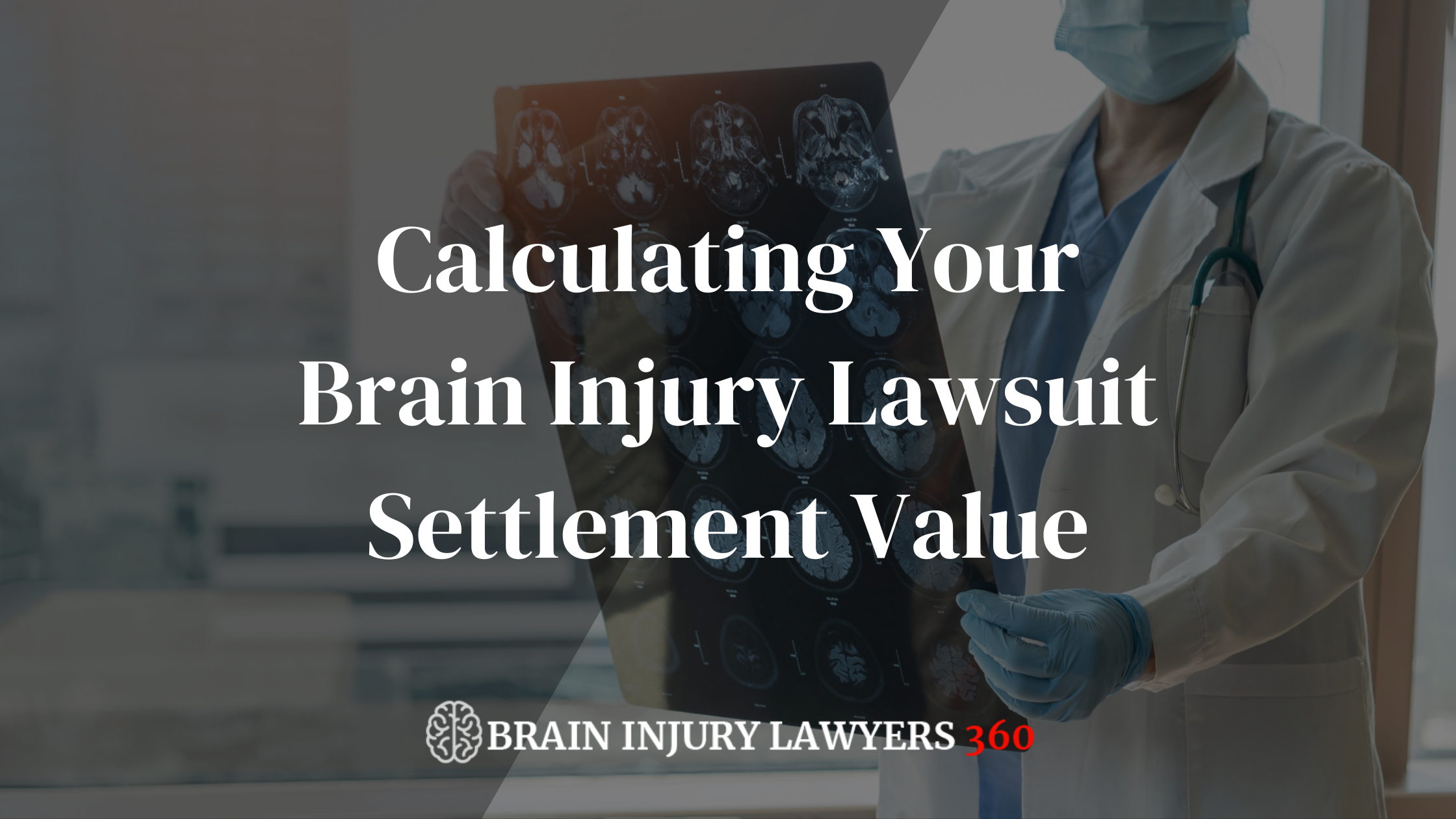 Calculate Your Brain Injury Lawsuit Settlement Value